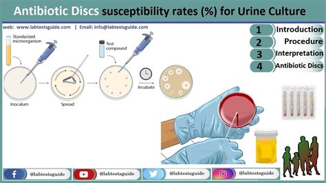 Urine Culture And Sensitivity Test .